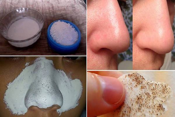 Utiliser Quelques Ingredients Ils Vous Aideront A Dire Au Revoir Aux Gros Pores 1