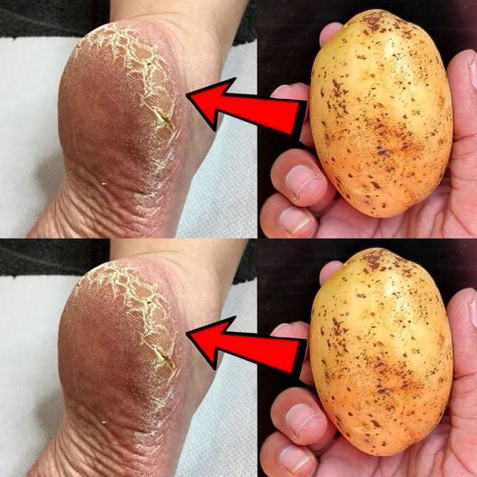 450071462 400711243007687 7686093197482768843 N