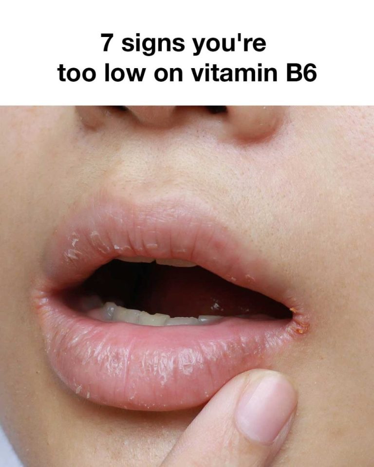 1a5231b8ff661c5fd658f4dbf7dad07c