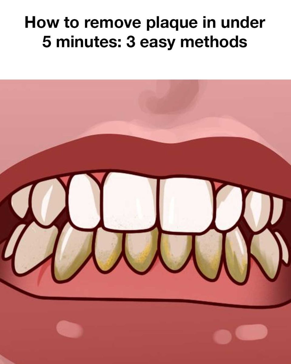 1b4e6255f00562314ec3000e1cc813a5