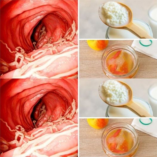 461415740 122176827740175854 369685486234220179 N