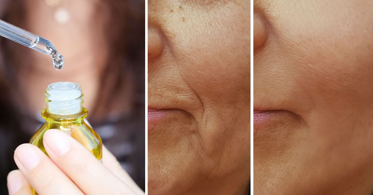 Come Preparare Siero Viso
