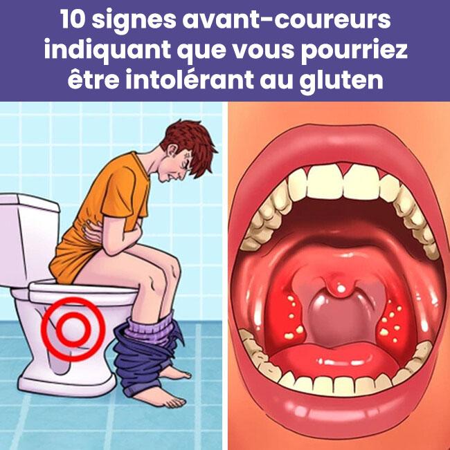 10 Signes Avant Coureurs Indiquant Que Vous Pourriez Etre Intolerant Au Gluten (1)