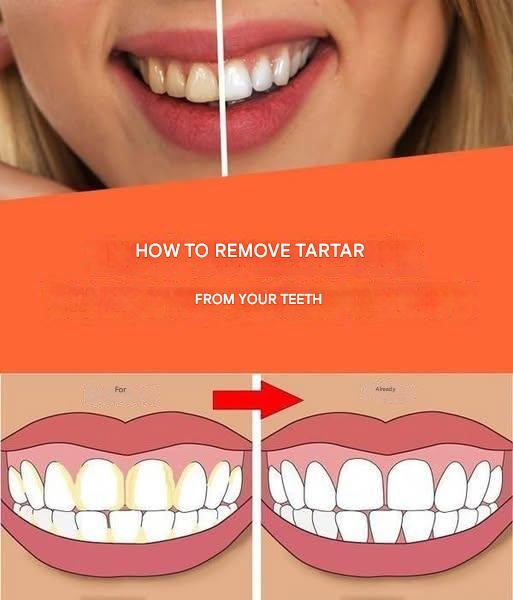 481247920 1200442624987684 9163065395676969629 N(1)