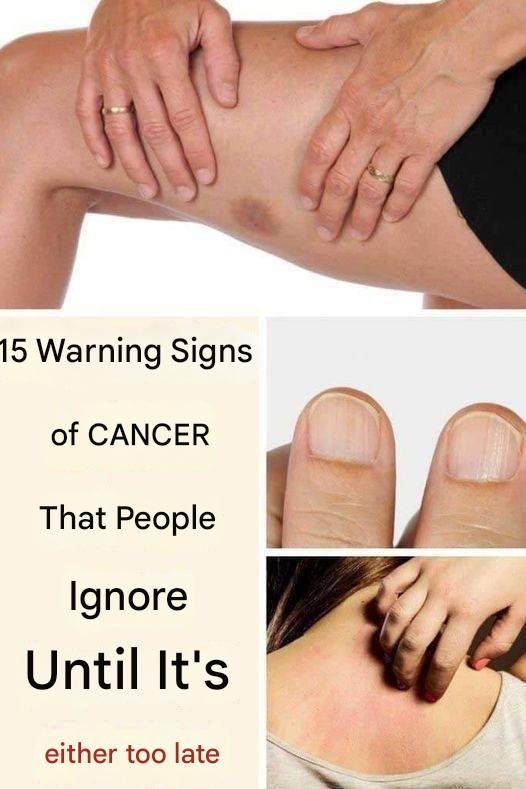 481767254 1330783665246665 6981214619643663005 N(1)