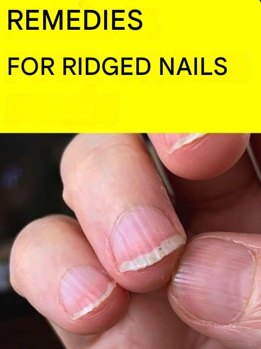 483526357 1338461477812217 1785556200375631360 N(1)