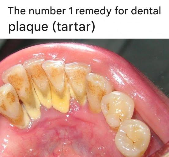 483860459 122151684116480977 2468858673818824511 N(1)