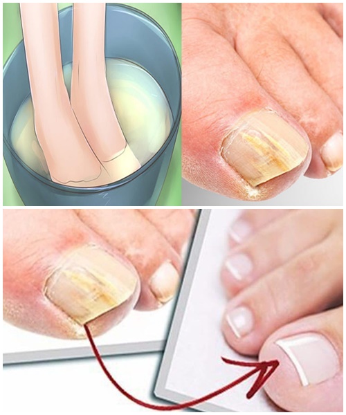 485474587 677107071637644 4407776769137923885 N