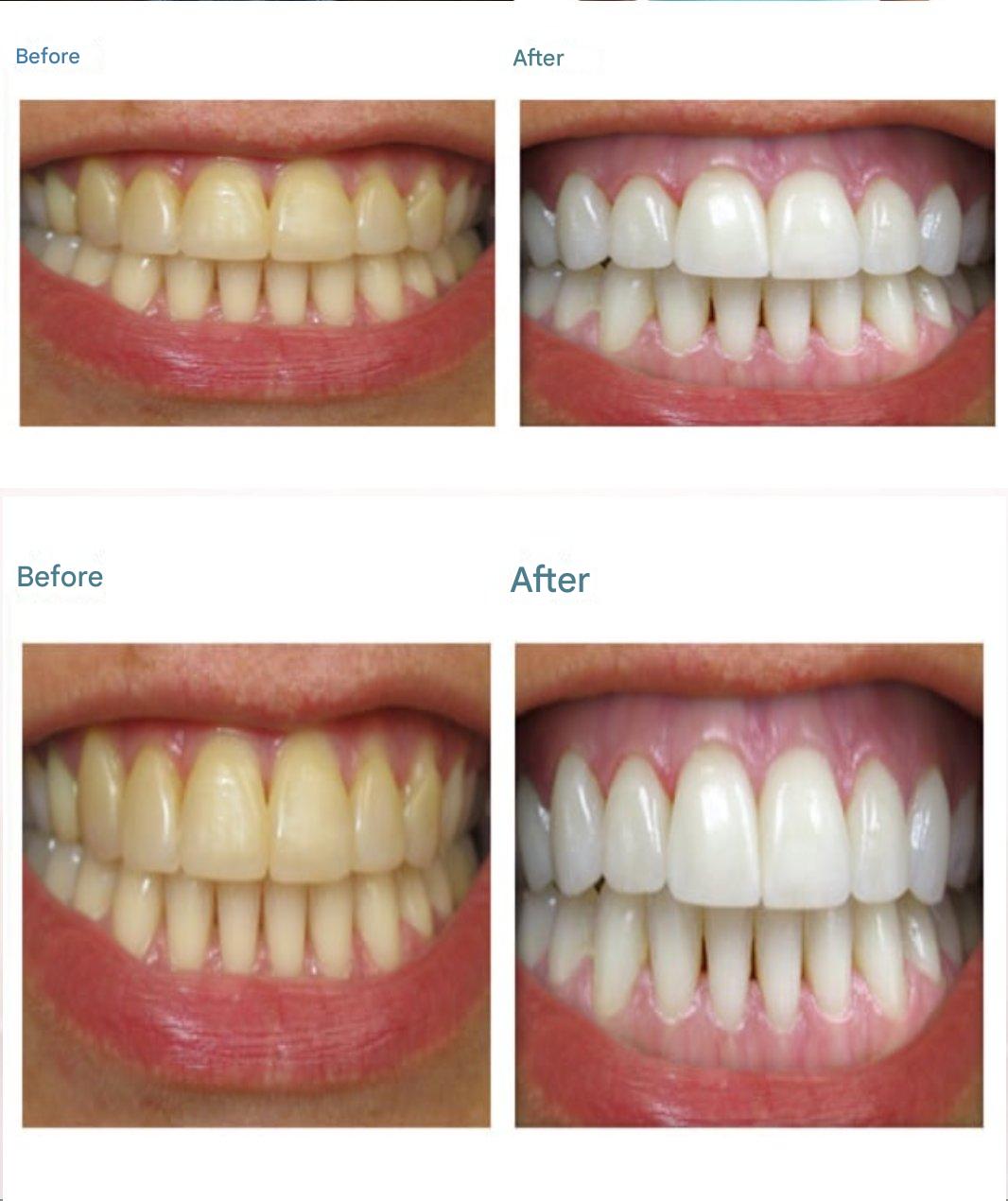 485604992 1216956640002949 5297387190825630352 N(1)