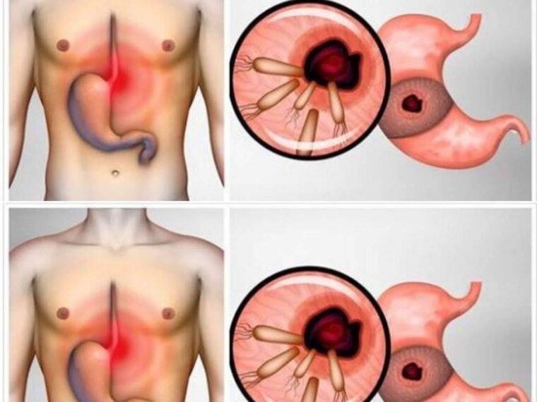 485727820 1215860916779188 7206608750324458049 N