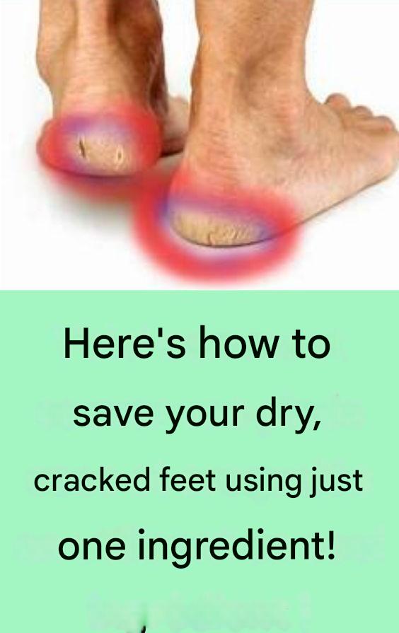 486062511 1346799400311758 5705673900690966096 N(1)