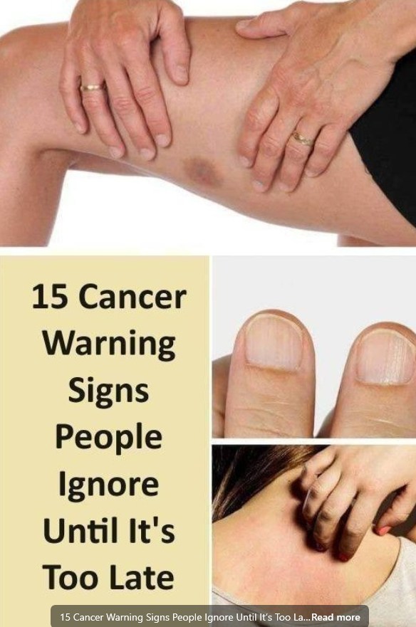 487149987 122126427872687801 4641590389742412805 N