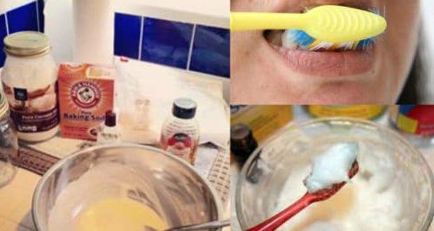 Blanchissez Vos Dents Et Eliminez La Mauvaise Haleine Le Tartre Et La Plaque Dentaire Avec Ce Seul Ingredient 1