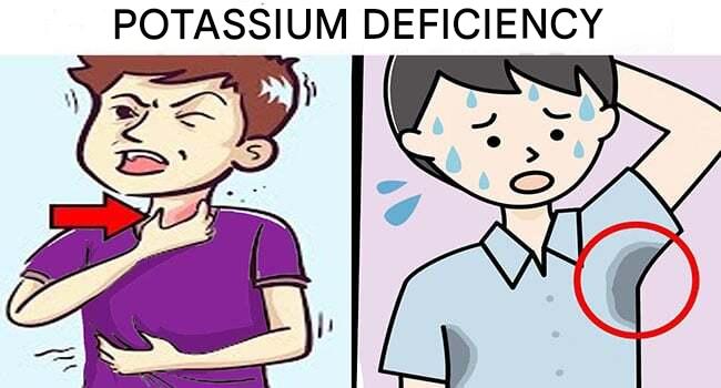 Carence Potatium6 650(1)