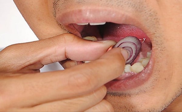 Mal De Dents