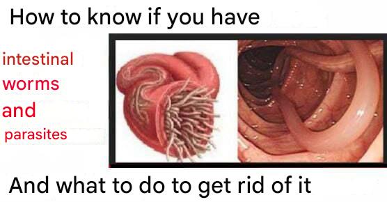 Parasites(1)