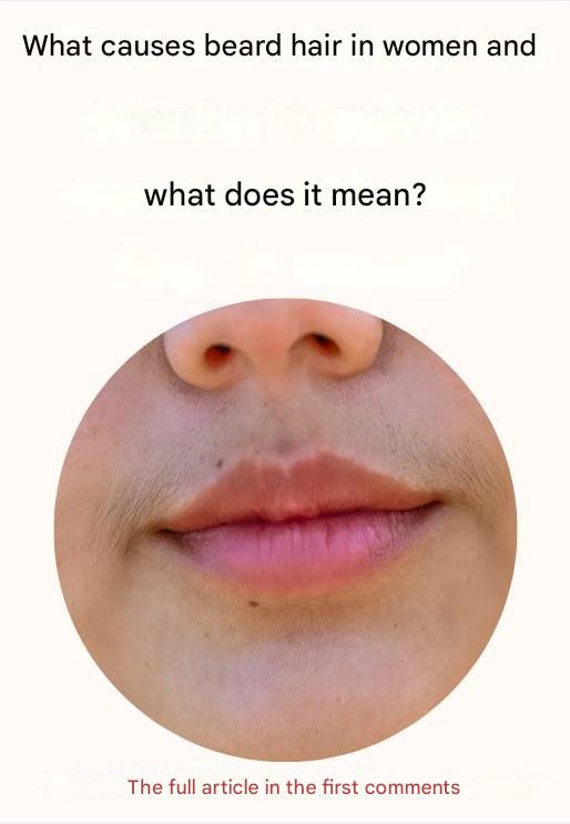 481129126 122189419166254952 5115123345509375094 N 1(1)
