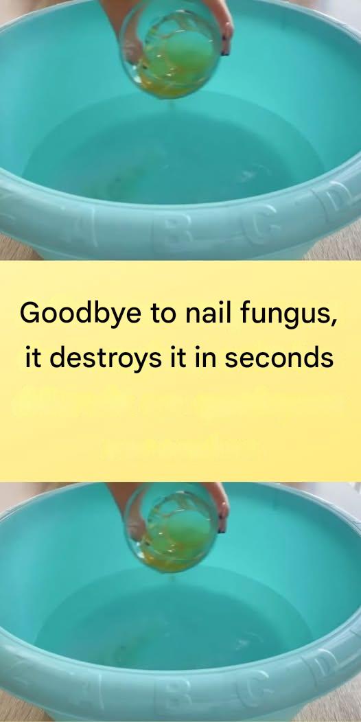 489944651 1364577505200614 5796817874539471863 N(1)