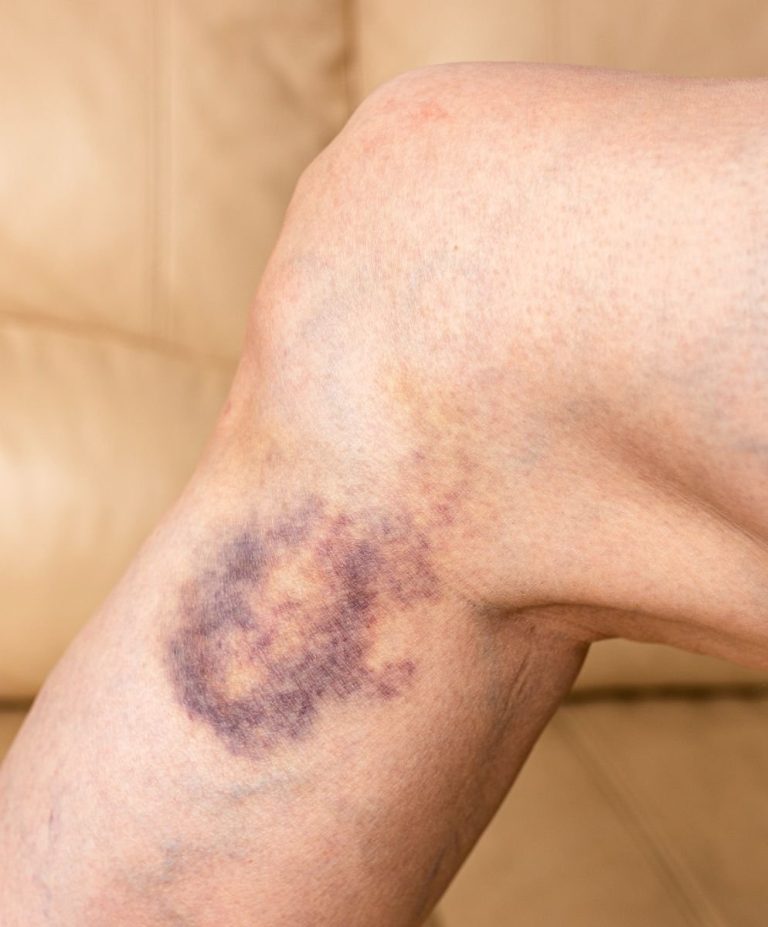 490489393 644712608525244 9151822965693089451 N