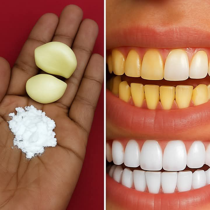 492228393 122156702618521501 5883283111299071094 N