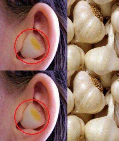 493006659 122129396810719780 3252430000192521031 N