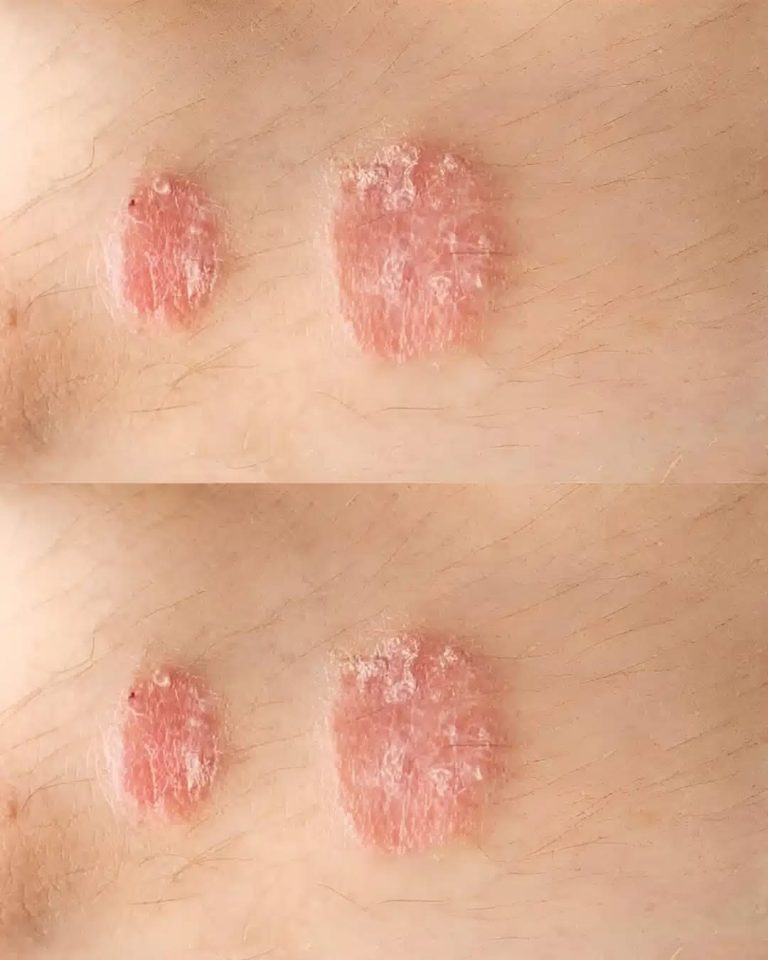 493468378 1685118519041152 2299562559729182443 N