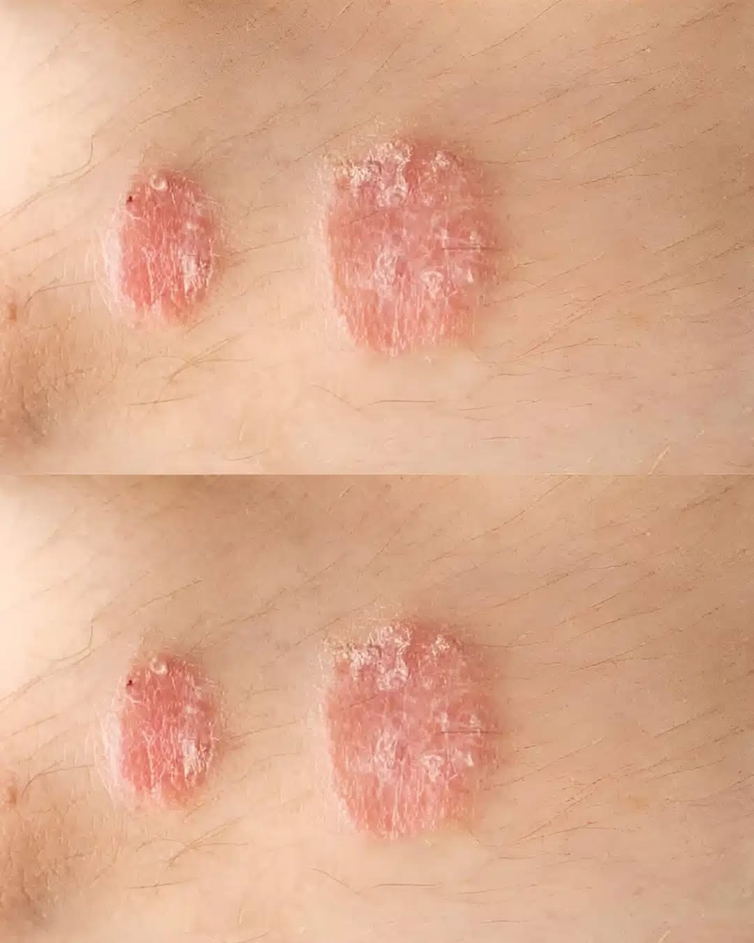 493468378 1685118519041152 2299562559729182443 N