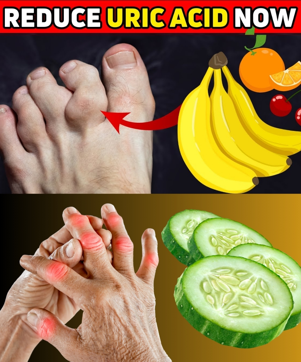 Top 8 Natural Foods To Lower Uric Acid Levels