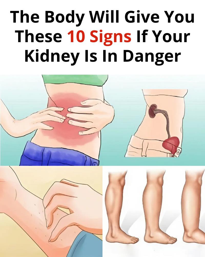 495433871 988903563458437 3002001674271617497 N