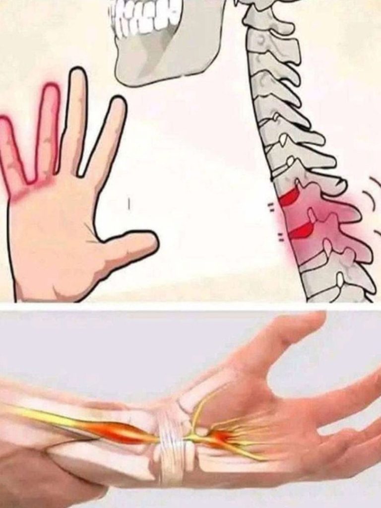 513379174 122136035582794311 1923635743713630954 N