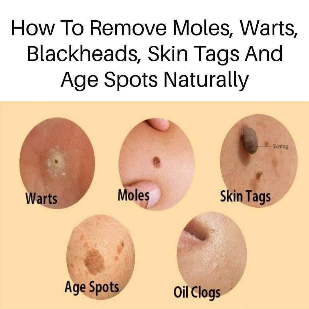 117 38