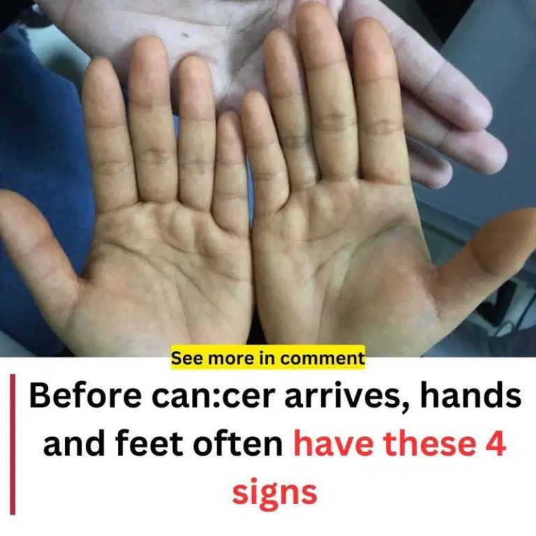 1 6
